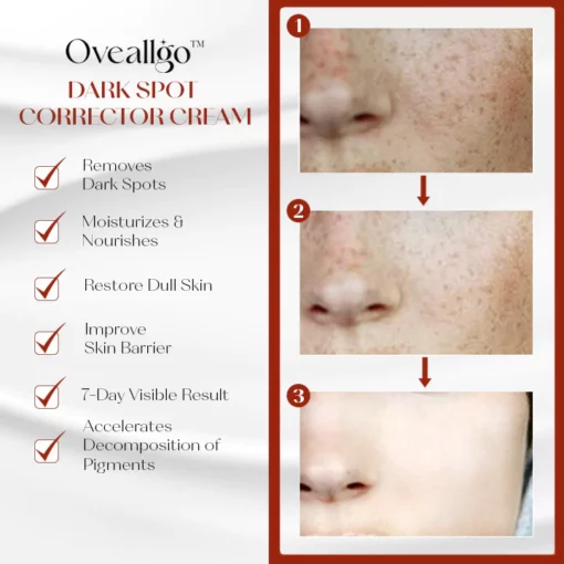 Oveallgo™ ProX Dark Spot Corrector Cream - Image 3