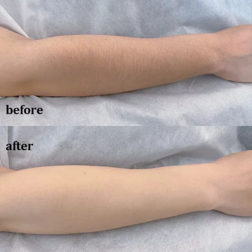 LIMETOW™ Breeze Pure Body Wax - Image 8