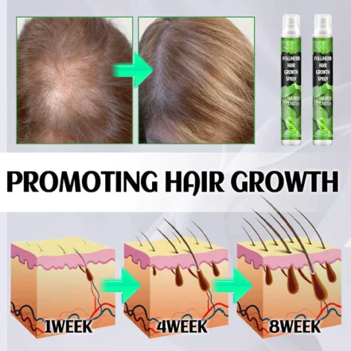 Fivfivgo™ FolliHerb Hair Growth Spray - Image 3