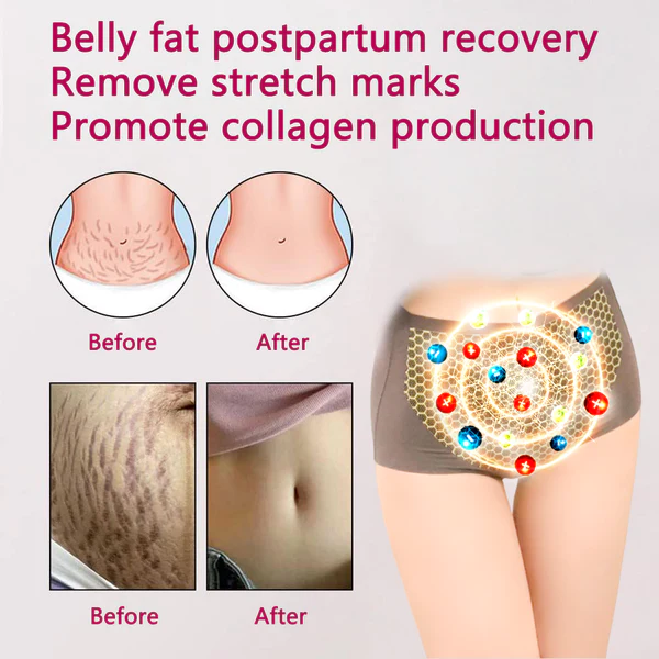 Magnetic Nano Ion Fat Burning Belly Controlling Detoxifying Shaper - Image 3