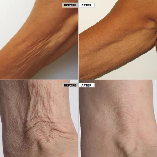 Seurico™ Skin Firm Body Serum Treatment - Image 8