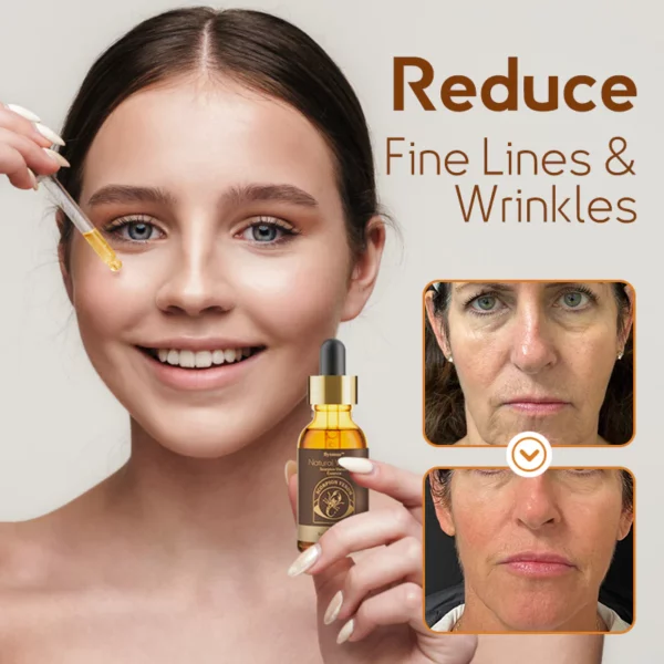 flysmus™ Natural Vitality Scorpion Venom Essence - Image 5