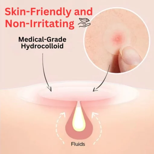 Oveallgo™ Nighttime Acne Patch - Image 3