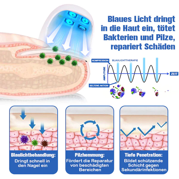 Furzero™ Nagelpilzreinigung Laser Linderungsgerät - Image 5