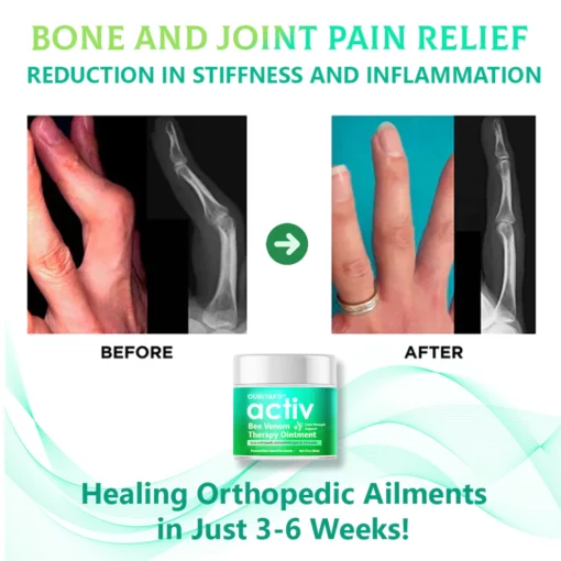 Ourlyard™ ACTIV Bienengift Gelenk- und Knochentherapiecreme - Image 4