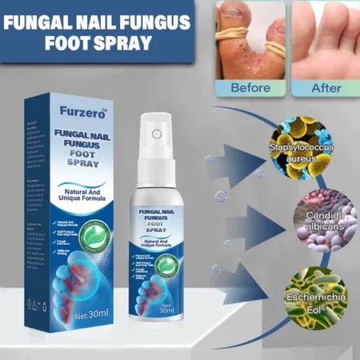 Furzero™ Nail Fungus Foot Spray - Image 8