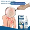 Ourlyard™ Psoriasis Treatment Spray