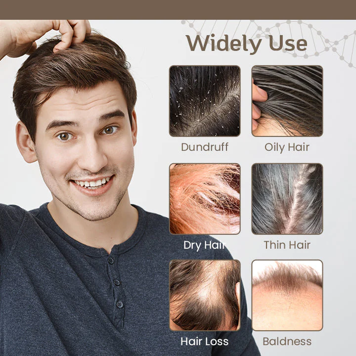 LIMETOW™ Hair Regrowth Treatment Spray - Image 6