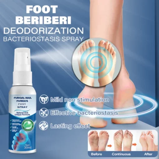 Furzero™ Nail Fungus Foot Spray - Image 4