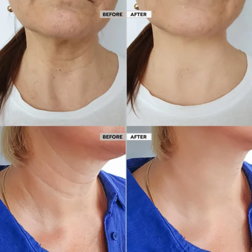 Seurico™ Skin Firm Body Serum Treatment - Image 7