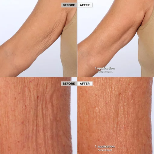 Seurico™ Skin Firm Body Serum Treatment - Image 6