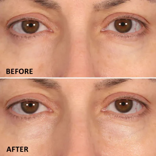 Seurico™ Eyelighter Concentrate Eye Serum - Image 3