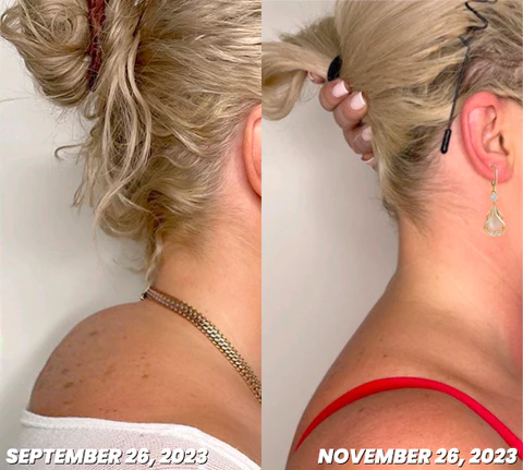 CZTICLE™ Magnetogen Ohrringe für den Lymphfluss - Image 3