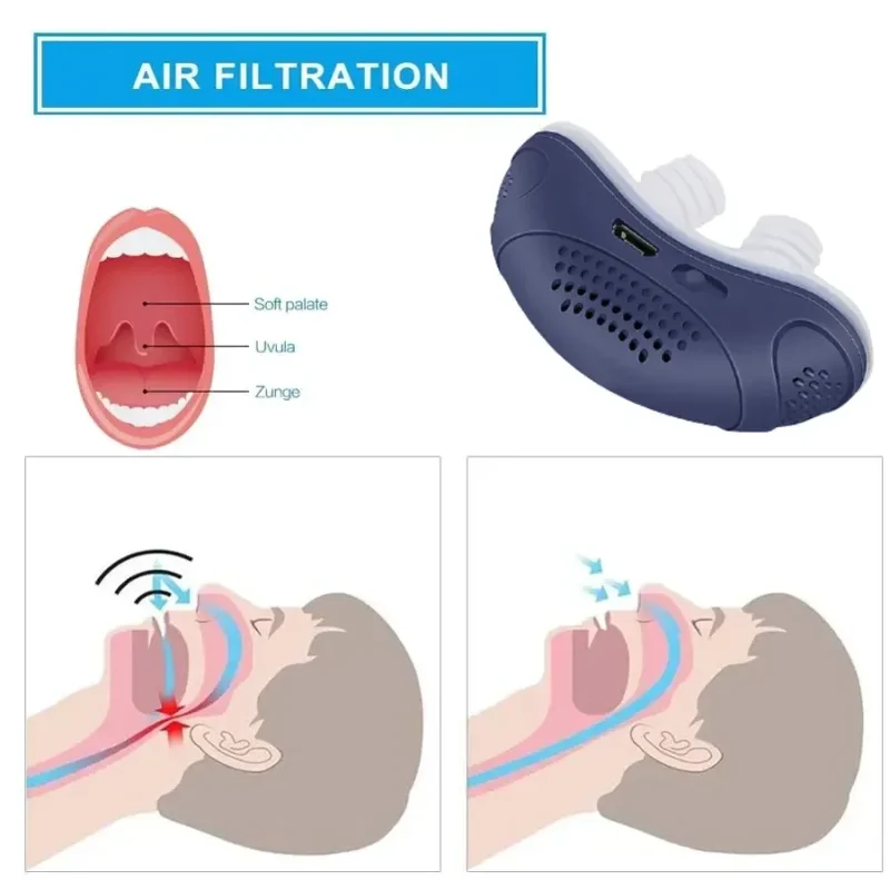 Schlaflos, maskenlos, Micro-CPAP Anti-Schnarch - Image 12