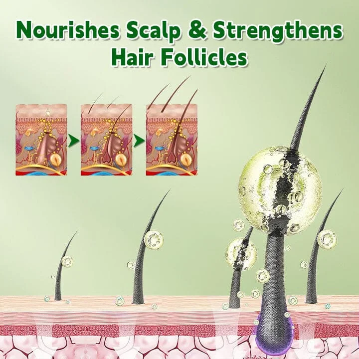 Fivfivgo™ LuxtroPro Ätherisches Rosmarinöl - Image 4