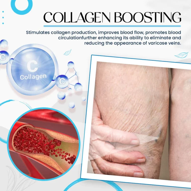 Dobshow™ Varicose Veins Treatment Cream - Image 8
