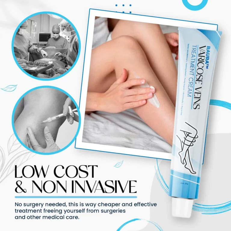 Dobshow™ Varicose Veins Treatment Cream - Image 5
