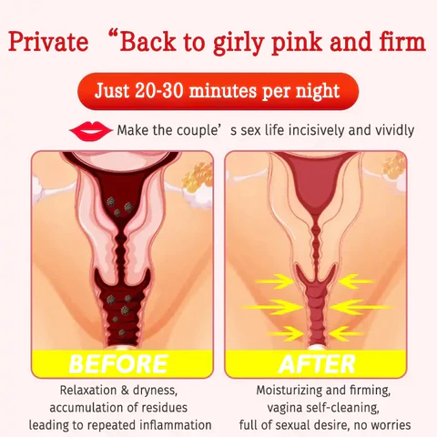 Furzero™ Instant Itch Relief & Natural Detox & Firming Repair & Pink and Tender Natural Capsules - Image 4