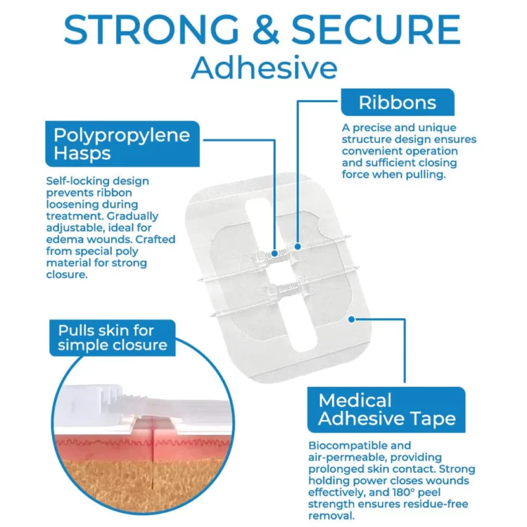 GFOUK™ StitchFree Closure Device - Image 4