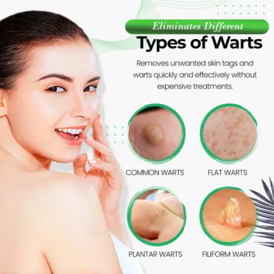 Oveallgo™ WartWipeout Soap - Image 7