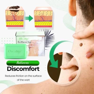 Oveallgo™ WartWipeout Soap - Image 4