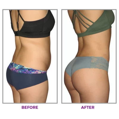 LIMETOW™ Hip Plump Capric Oil - Image 7