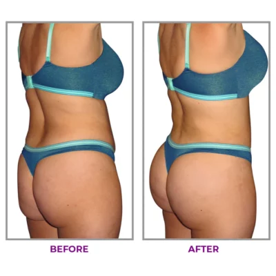 LIMETOW™ Hip Plump Capric Oil - Image 6