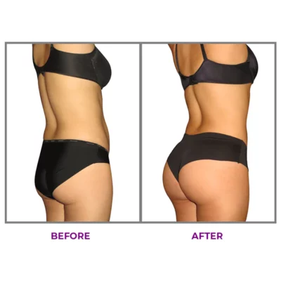 LIMETOW™ Hip Plump Capric Oil - Image 4