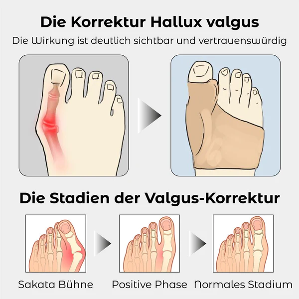 RICPIND Hallux Harmonie Korrekturgurt mit Schutzärmeln - Image 9