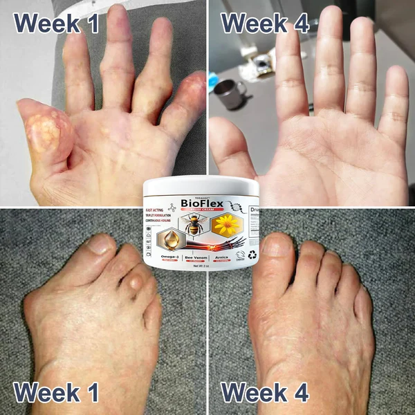 Tiworld™New Zealand Bee Venom Joint and Bone Therapy Advanced Cream - Image 7