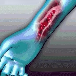 Bracelet Voilaist™ dernière génération 2024 - Image 15