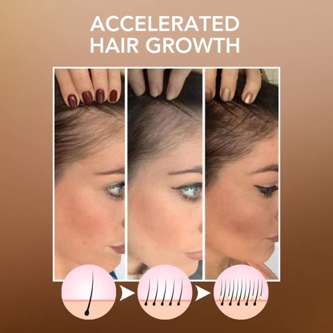 Fivfivgo™ Marokkanisches Haaröl - Image 7