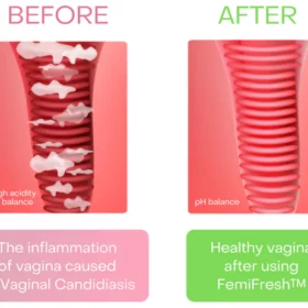 FemiFresh™ Vaginal Cleaning Patch - Image 6