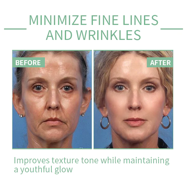 Tiworld® Luxury Collagen Boost Anti-Aging Serum For Remove 97% Deep Wrinkles & Dark Spots - Image 9