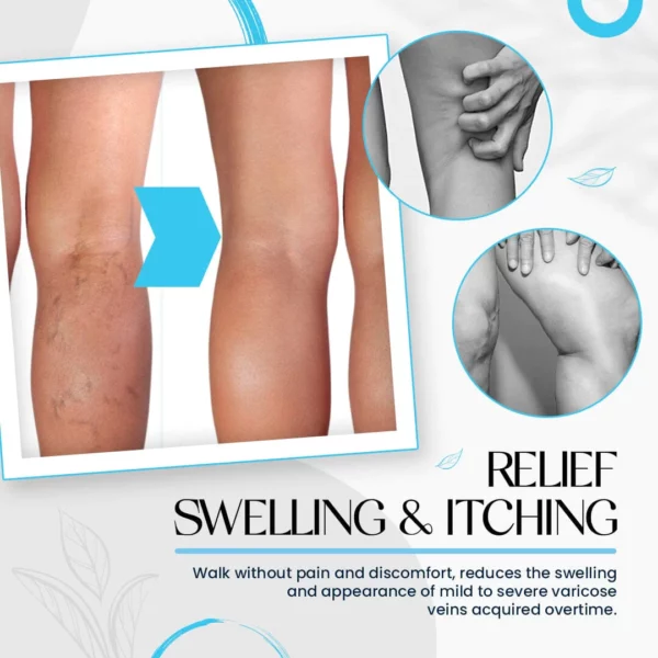 Raura™ Varicose Veins Cream - Image 8