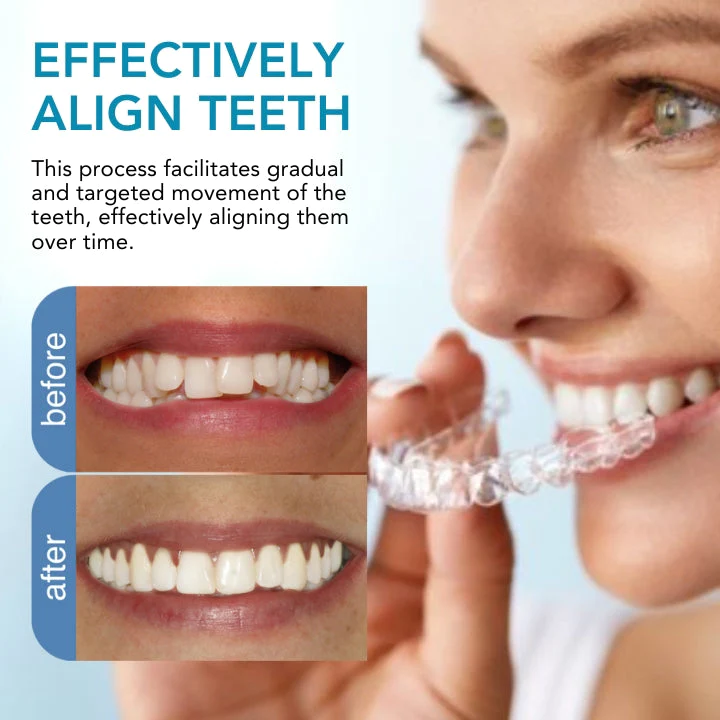 Fivfivgo™ Kieferorthopädie Begradigung Guard - Image 2