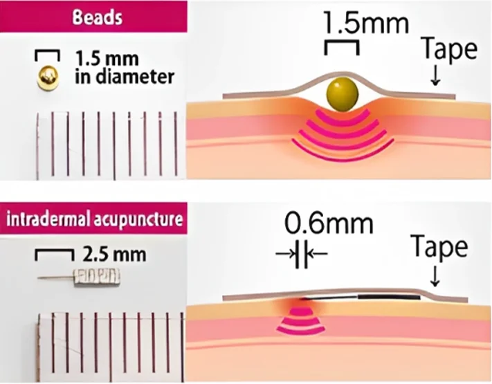 Cvreoz™ Quantum Resonance Ear Acupoint Harmony Patch - Image 5