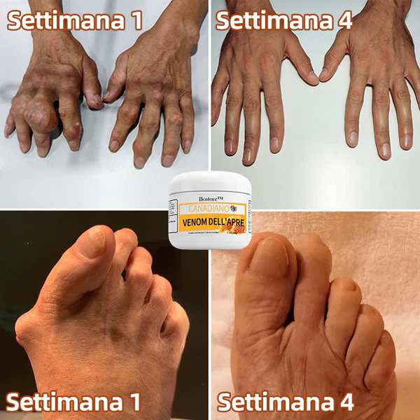 Bostore™ Canadian honey bee Venom Pain and Bone Healing Cream - Image 5