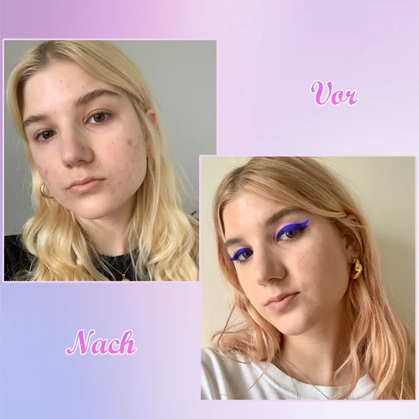 Oveallgo™ ChromeLuxe Gel-Liner - Image 6