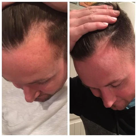 Fivfivgo™ Marokkanisches Haaröl - Image 6