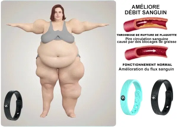 Bracelet Voilaist™ dernière génération 2024 - Image 12