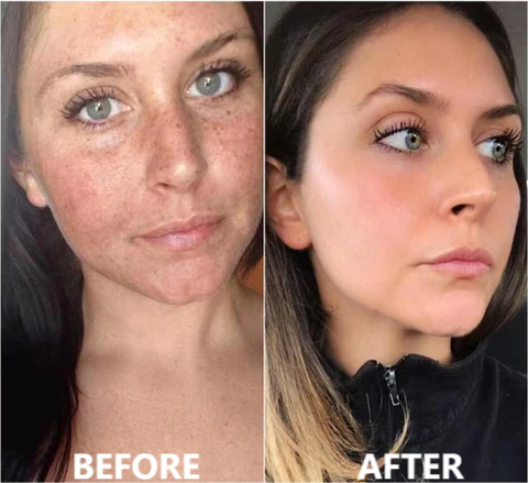 Tiworld® Luxury Collagen Boost Anti-Aging Serum For Remove 97% Deep Wrinkles & Dark Spots - Image 8