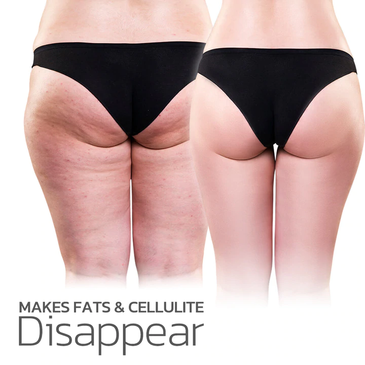 Mresio® EMS Radiofrequency Foot Massager - Image 4