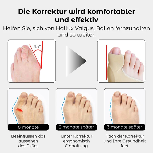 RICPIND Hallux Harmonie Korrekturgurt mit Schutzärmeln - Image 5