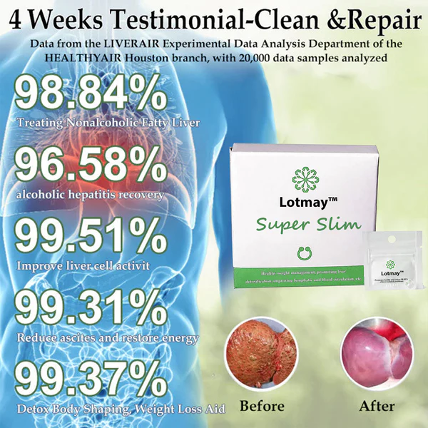 Lotmay™ Detox Slimming Essential Oil Nose Ring - Image 3