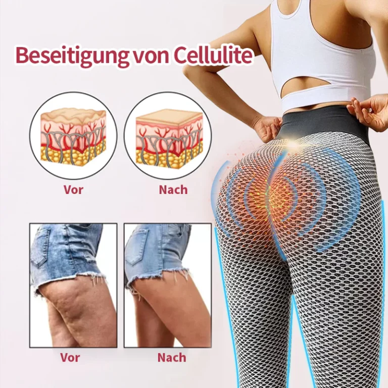 Anyidea™ Ionic Shapewear - Image 5