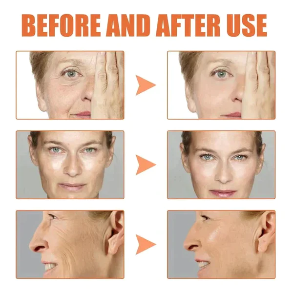 Tiworld™ Botox facial Serum - Image 16