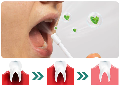 Furzero™ Herbal Mouth Spray - Image 3