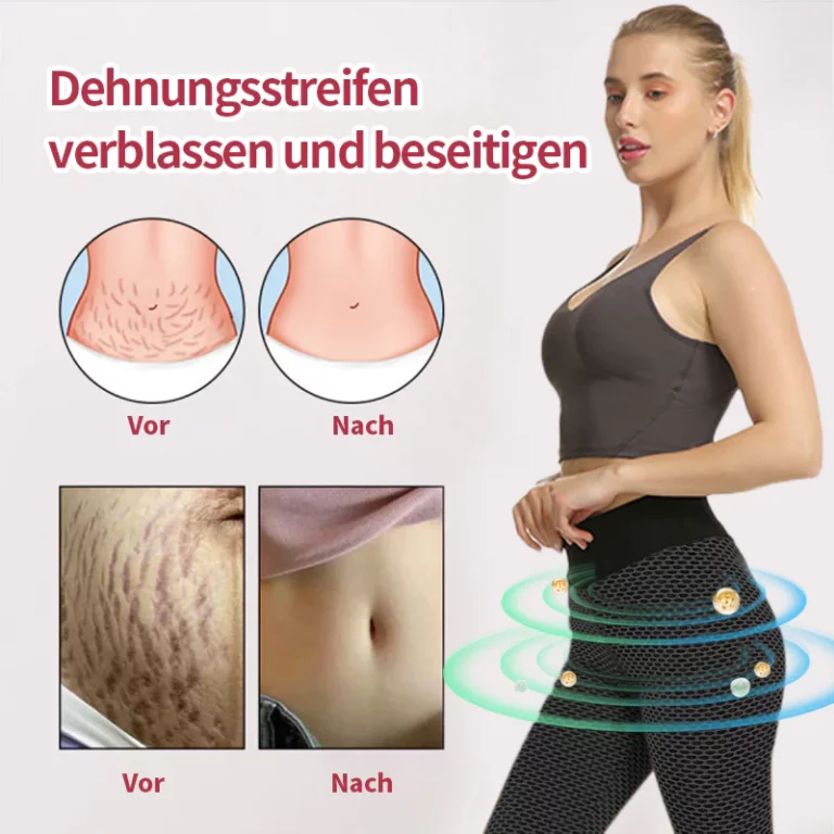 Anyidea™ Ionic Shapewear - Image 4