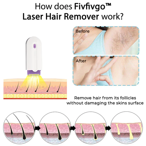 Fivfivgo™ Laser-Haarentferner - Image 5